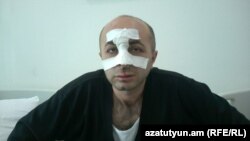 Nagorno-Karabakh - Oppsition leader Hayk Khanumian at a hospital in Stepanakert. 7June, 2016.