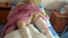 One of the injured in the Minsk explosion