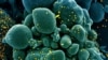 Imagine a unei celule (în verde) infestate cu noul coronavirus (în galben), realizată de cercetătorii americani